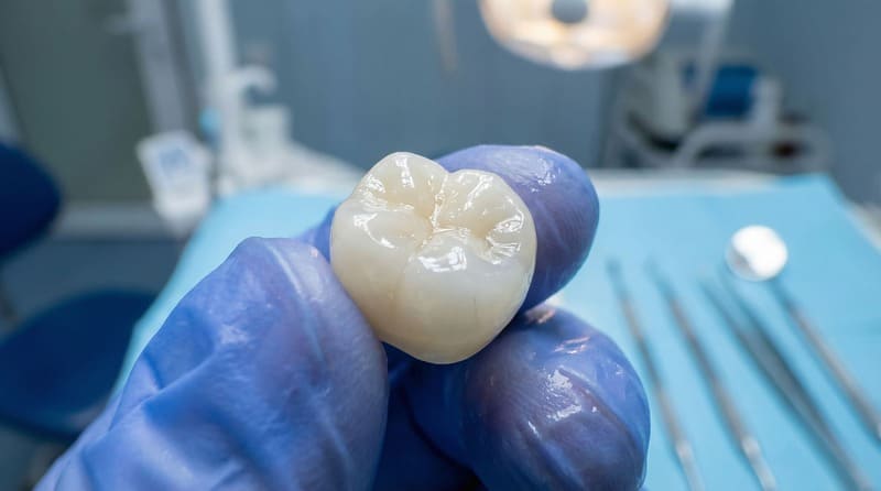 Zirconia dental crown vs metal ceramic cap comparison.